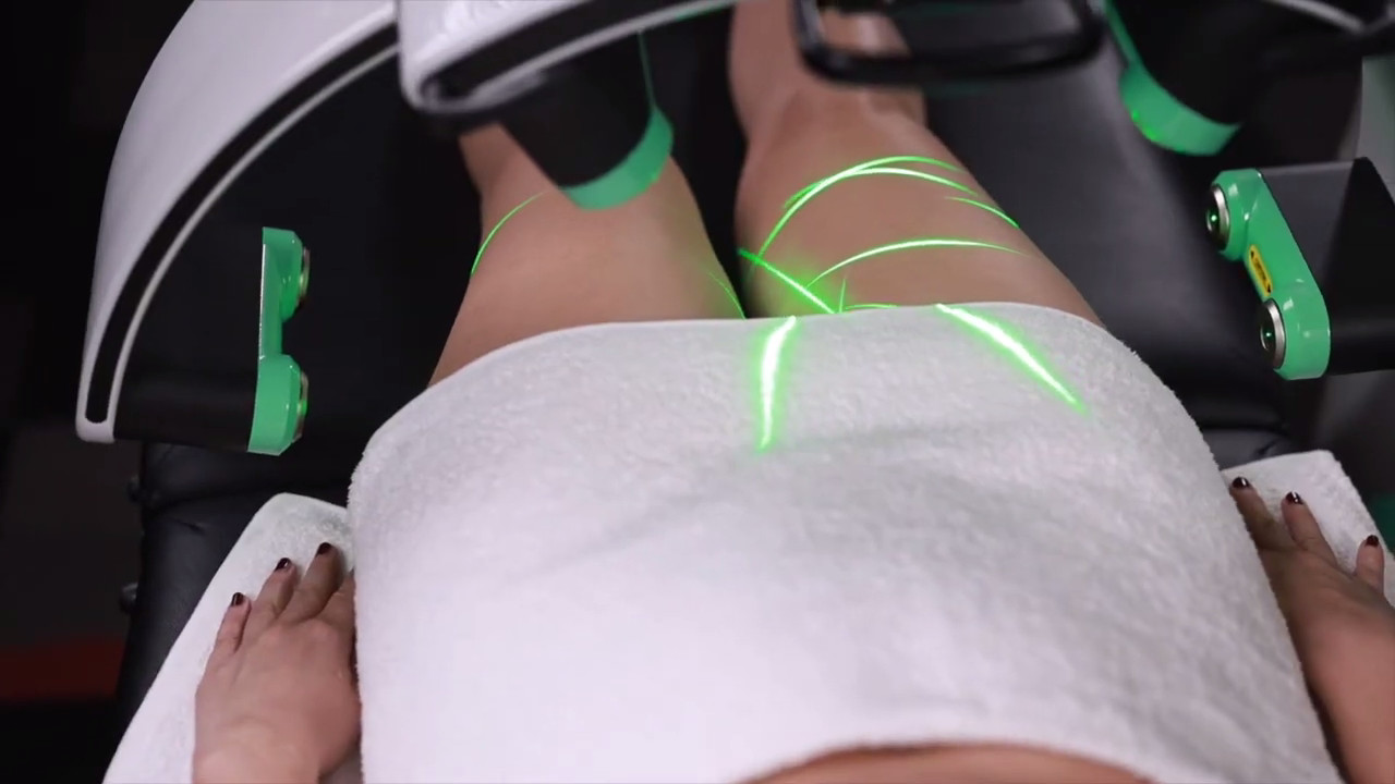 532nm Green Light Therapy Cold Laser Fast Slim Machine 10D Cellulite Reduction For Beauty Salon