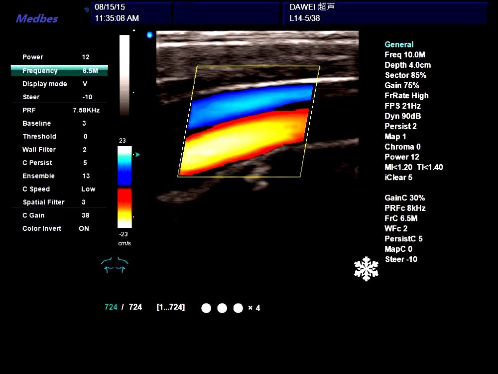 Tender Ultrasound 4D Digital Color Doppler Cheapest Ultrasound Machine Color Doppler Scanner