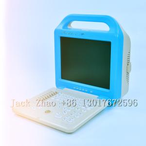 China Medbes Full Digital Ultrasound Scanner Machine Price wholesale