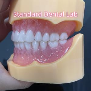 China Durable Dental Prosthesis Full Arch Acrylic Teeth Partial Removable Dentures wholesale