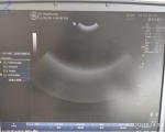 GE 6S-RS Phased Ultrasonic Transducer Sonography Hospital Clinic