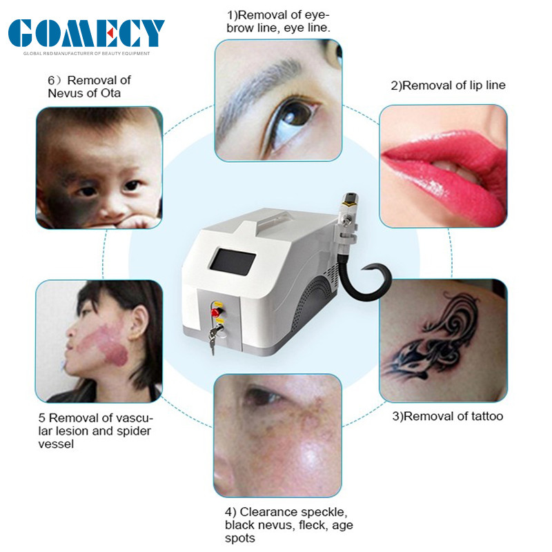 Q Switched ND Yag Laser Machine 1064nm 532nm For Removal Eye Wrinkles