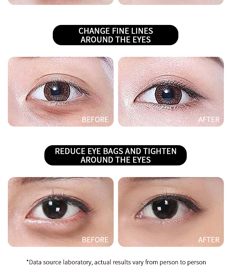 Firming And Moisturizing Reducing Fine Lines Dark Circles And Bag Removal Eye Dark Circles Remove Cream