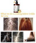 Anti-Hair Loss Ginger Shampoo 500ml Private Label for Oil Control and Healthy