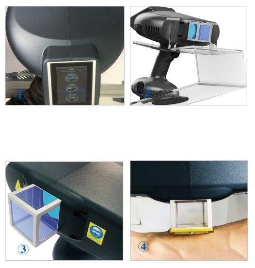 CFDA Psoriasis Vitiligo Excimer Laser Side Effects XeCl