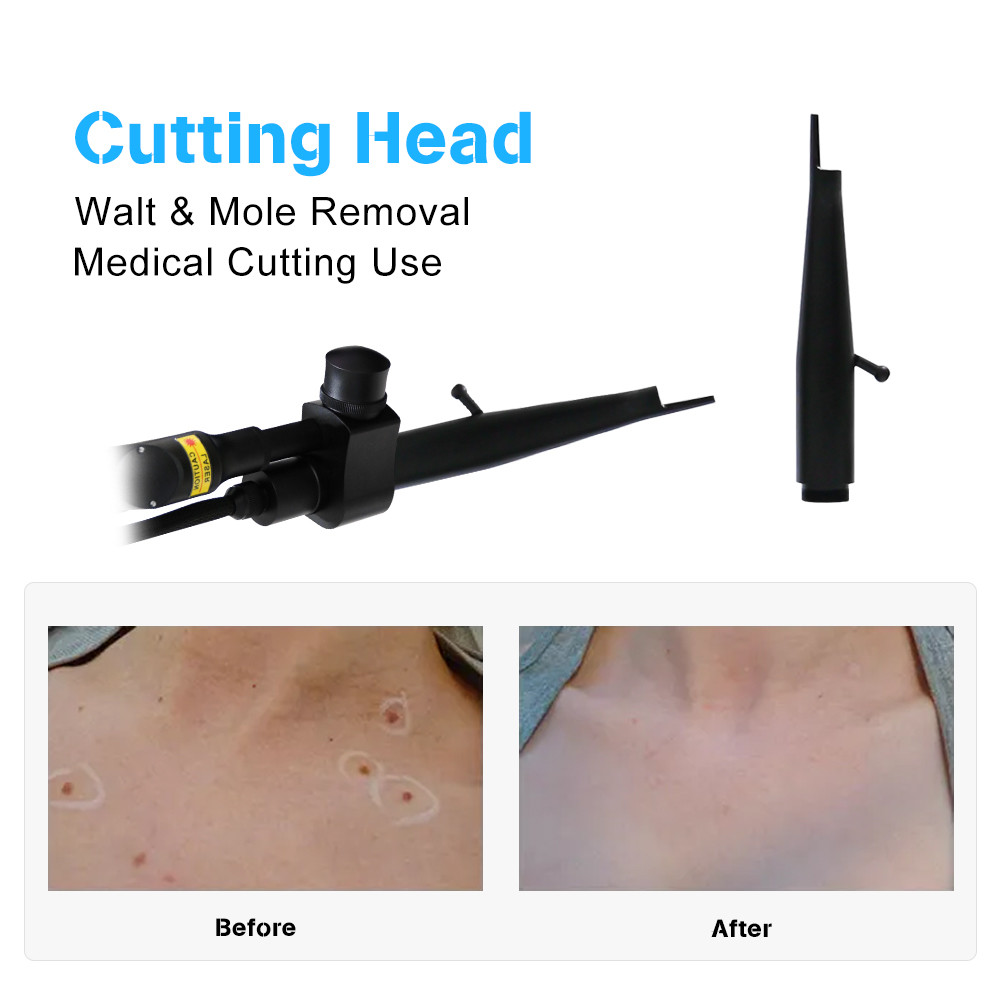 BV13 Vertical 30w 60w Co2 Laser Beauty Equipment For Salon With Ce Approval Co2 Fractional Spot Scar Removal Laser