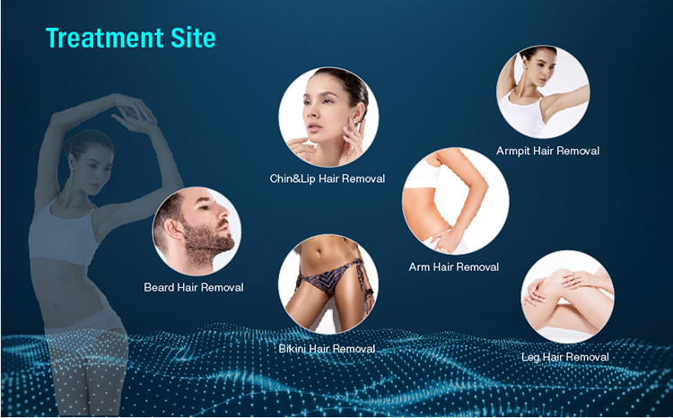 808nm Diode Laser Hair Removal Machine 1800W 12 Laser Bar diode ice laser