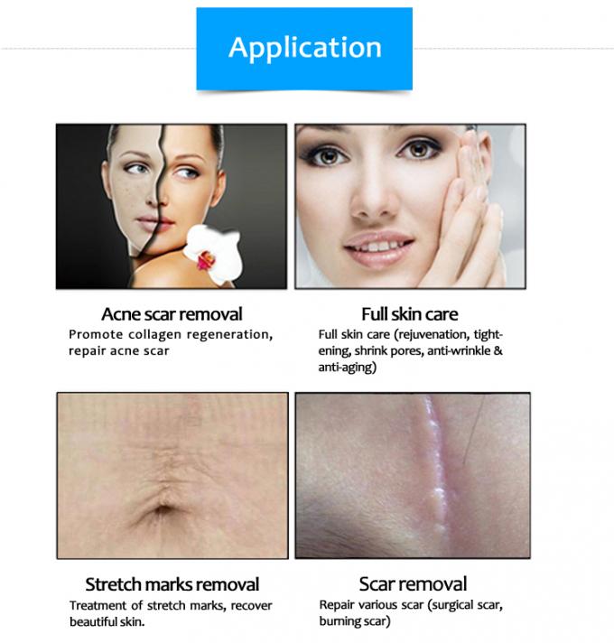 30W RF - Excited CO2 Fractional Laser Stretch Mark Removal Machine Ultrapluse 10600nm 1