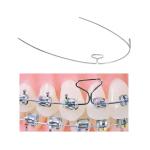 CE certificated Dental Metal Orthodontic Elastics Braces Ligature Tie