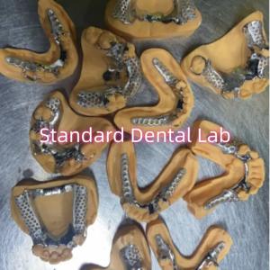 China Removable Cobalt Chrome Cast Metal Framework Partial Dentures wholesale