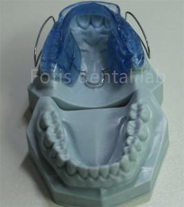 China China Dental Lab Orthodontic Retainer Expander Adjustable And Customizable wholesale