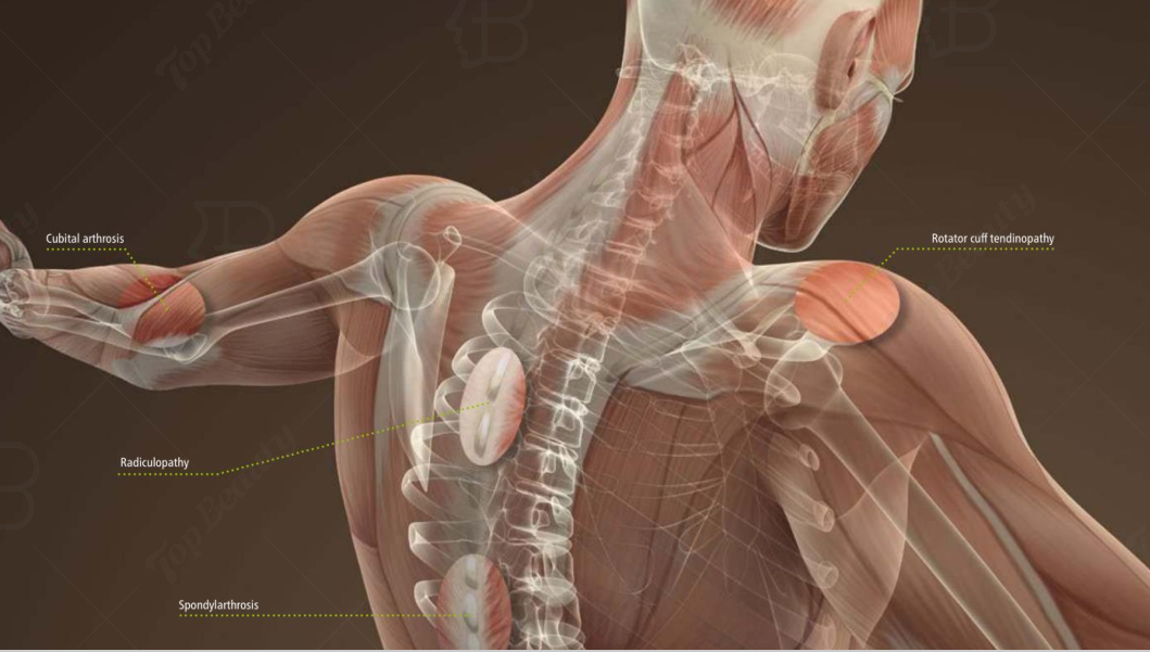 Touch Screen Magnetic Therapy Device 300Khz Frequency Physical Musculoskeletal Therapy Machine