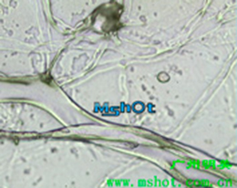 Monocular biological microscope for basic laboratory