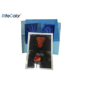 Digital Dry Medical Imaging Film For X Ray PET Inkjet Blue Medical Film 210mic