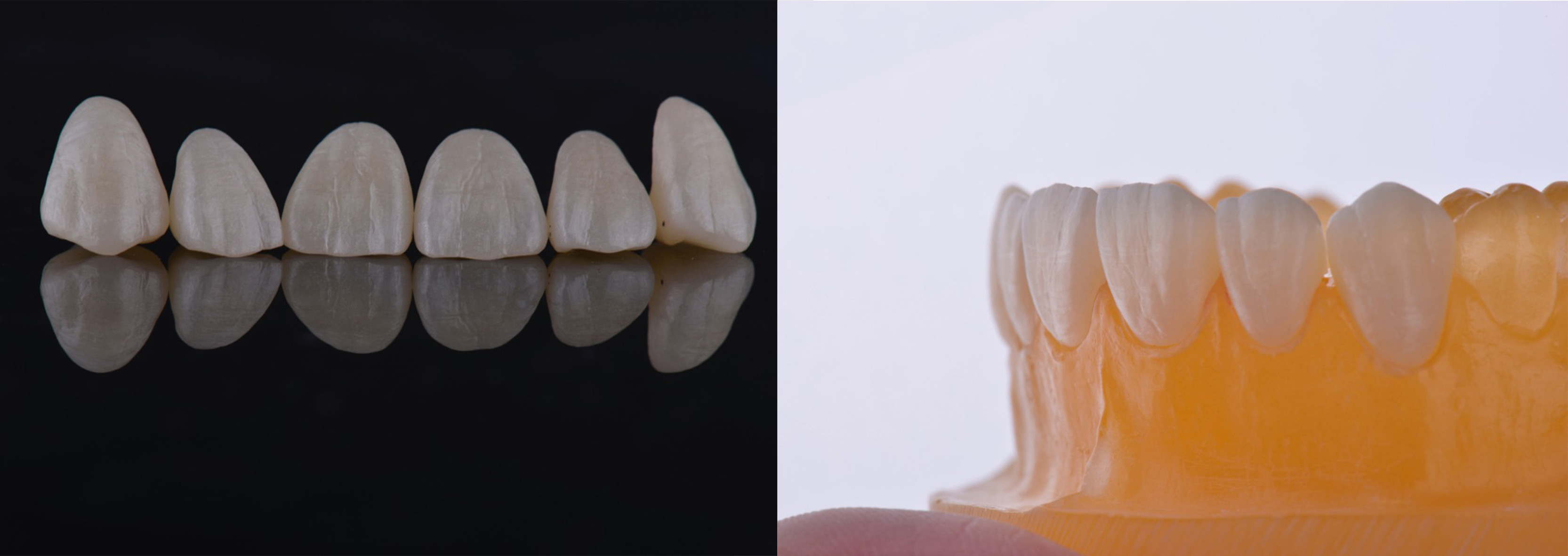 UT Ultra Translucent Open System CAD CAM Zirconia Blocks