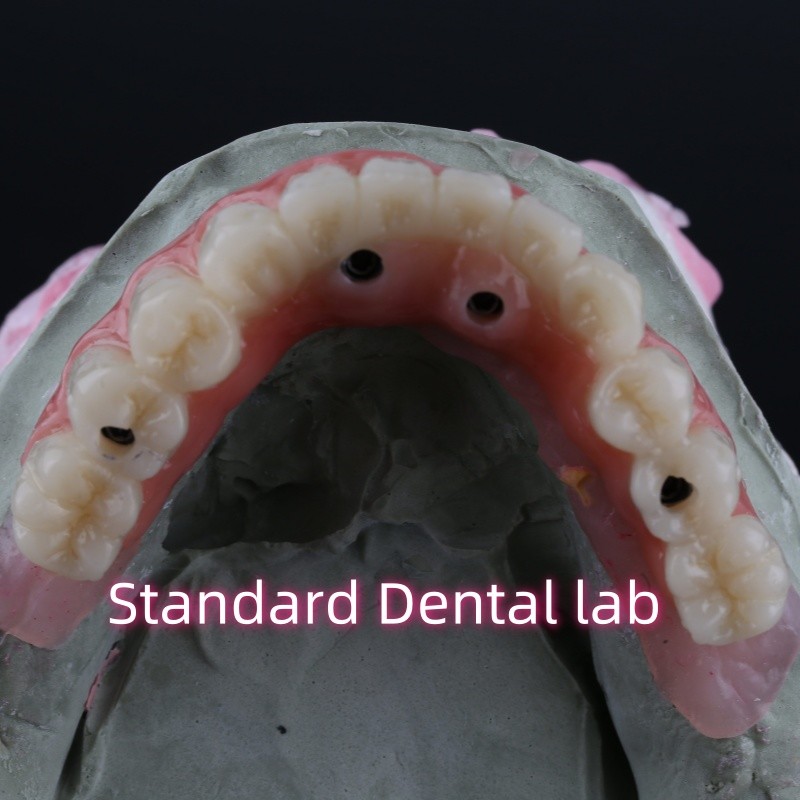 Porcelain Zirconia Dental Implant Bridge Professional High Esthetics With Pink Gum