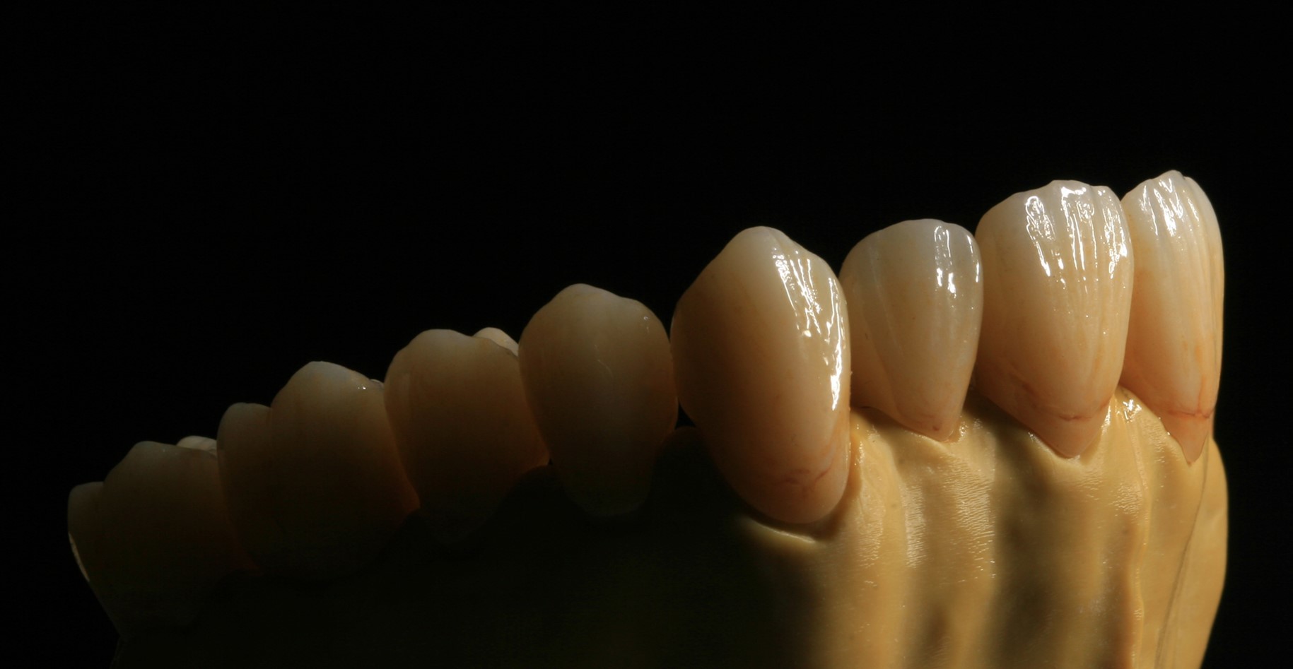 Dental Lab Fixed Prosthetics Layered Zirconia Dental Crown For Front Teeth