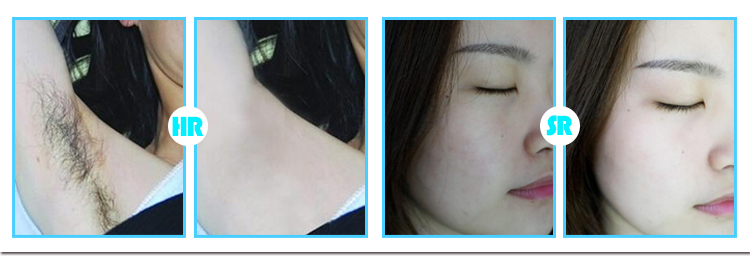 Mini Photorejuvenation IPL Machine Skin Rejuvenation 1.7KG Weight