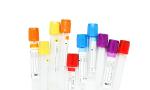 Capillary Tubos Vacutainer Blood Collection Accessories Red Plain Vacuum Tube