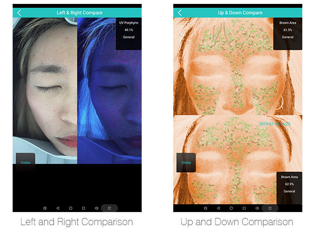 Magic Mirror Skin Analysis Machine Therapist Deep Detect 10 Years