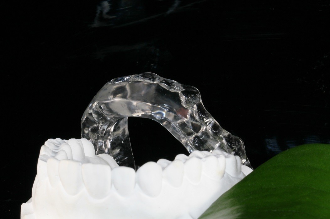 Custom Made Mandibular Arch Stablizing Bite Splint