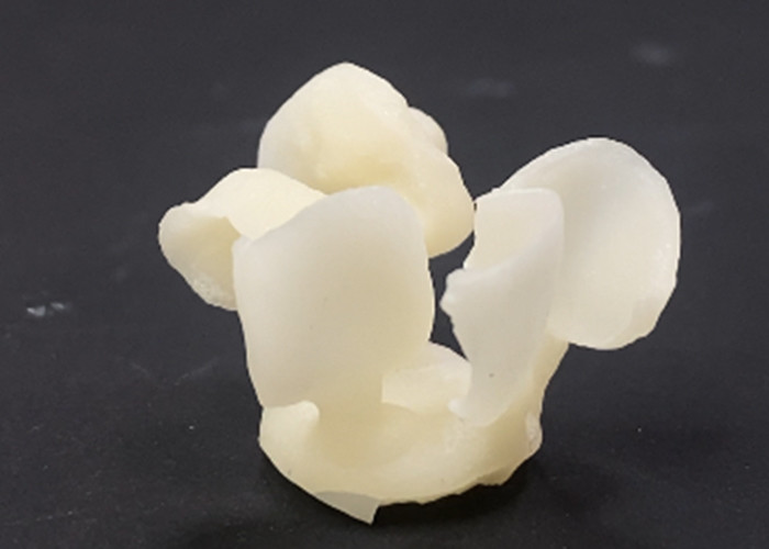 Cosmetic Dentistry EMAX Porcelain Veneers for Beautiful Dental Restorations
