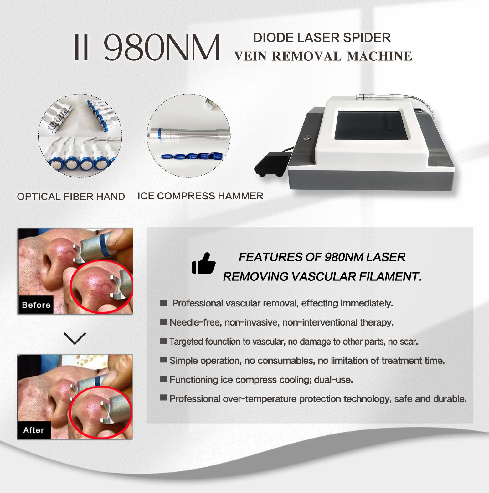 15ms-100ms 20W Spider Veins Removal Machine Face Body Age Spot Removal