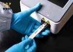 25T NGAL Rapid Quantitative Test Kit WWHS FIA POCT Assay