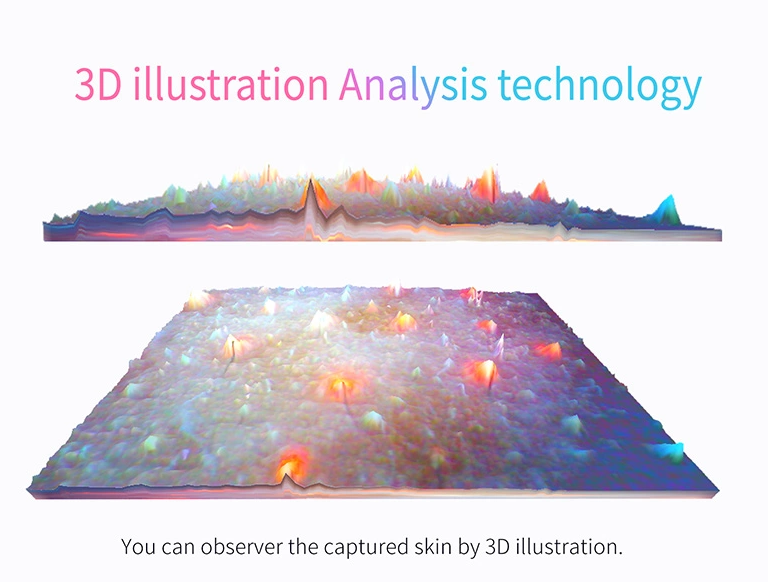 12 Million Pixels Camera Facial Analyzer with Touch Screen ' AI Skin Analysis of Full Face
