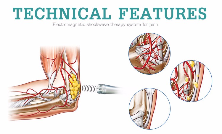 beauty machine shock wave vacuum therapy machine