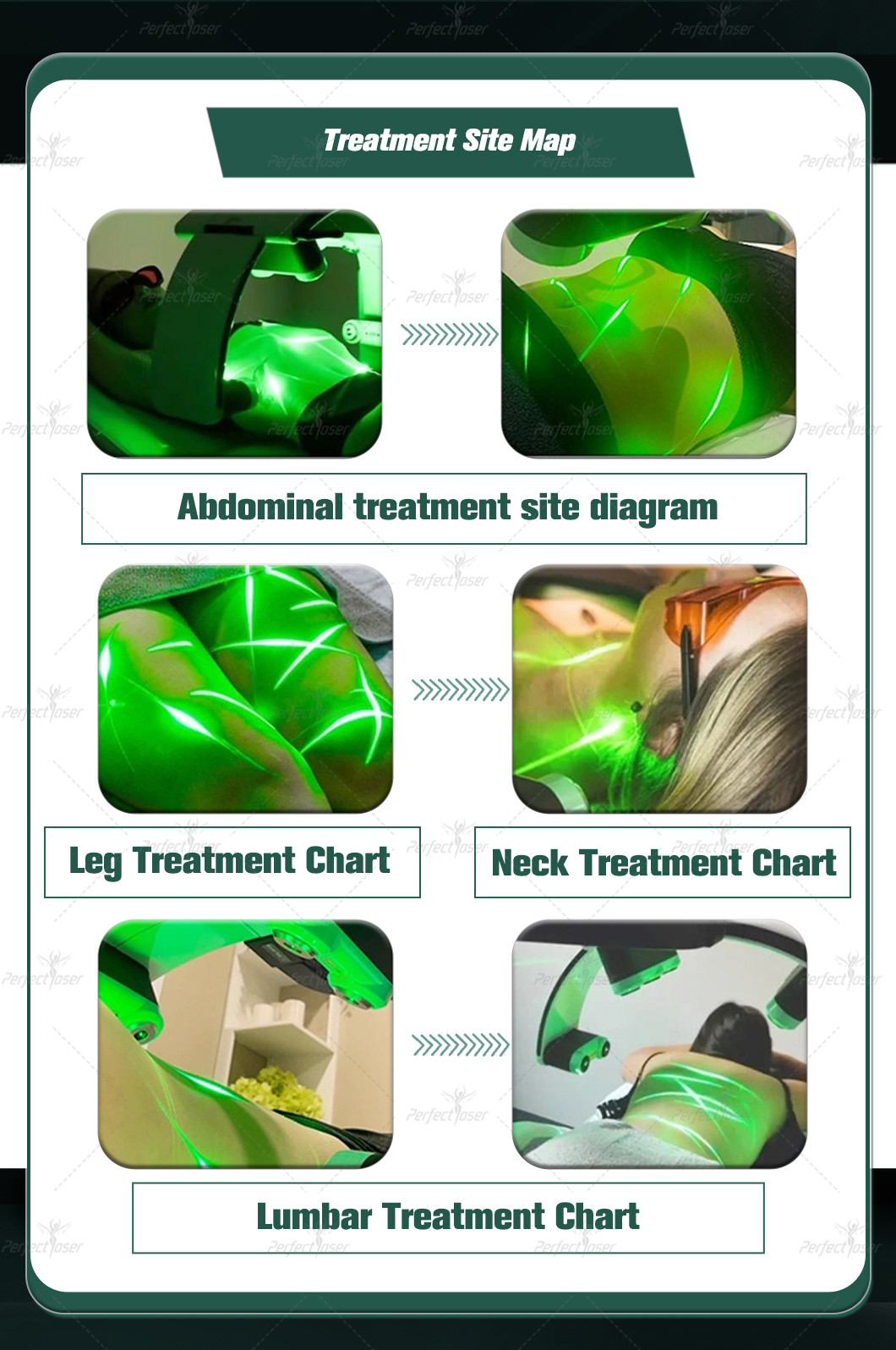 Slim Master 10d EMerald Lipo 532nm Diode Green Laser Body Slimming Fat Removal No Pain Cellulite Reduce Machine