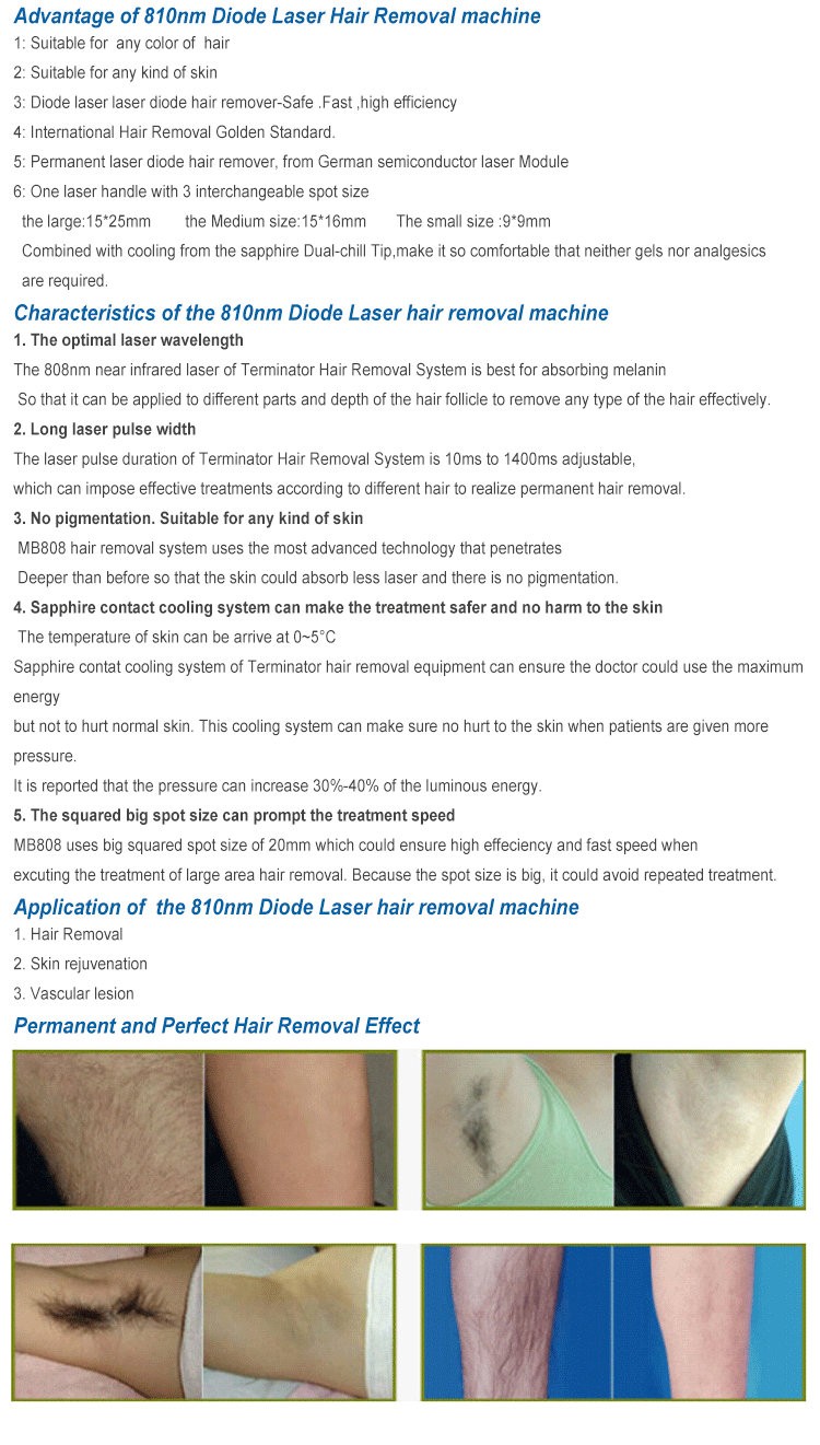 Factory price 810nm diode laser permanent hair removal 808nm on sale