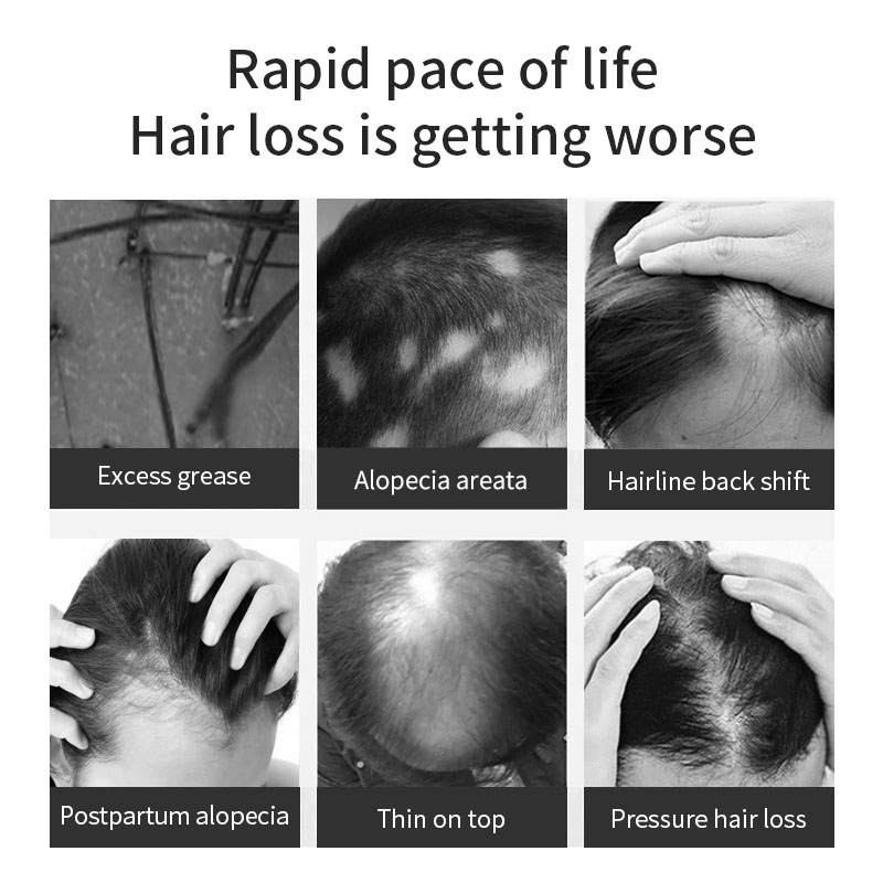 Customization Hair Growth Treatment Serum for Black Women Private Label