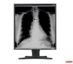 Anti-reflective Medical Grade Displays used in medical imaging equipment