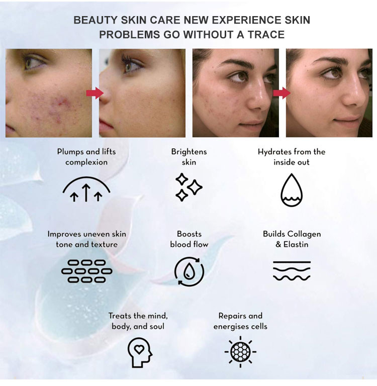 Skin Spa PDT LED Therapy Mask 150mAh Battery Skin Whitening