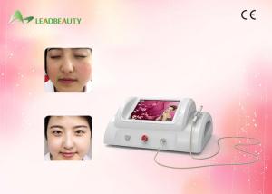 China Radio frequency Ablation Varicose Veins / Spider Vein Removal Painless 30Mhz wholesale