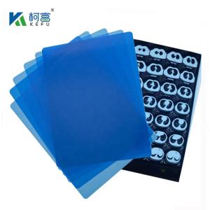China Hospital CT Medical Image Waterproof Inkjet Blue Medical X-ray Dry Film wholesale