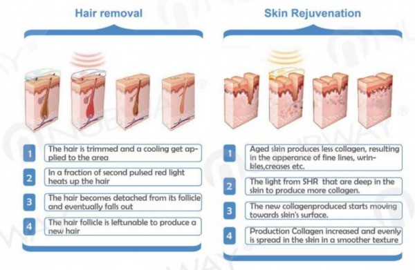 ipl portable designed,ipl men hair remover,ipl machine laser hair removal