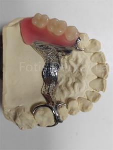 China Durable Odor Resistant Removable Partial Denture Highly Adjustable wholesale