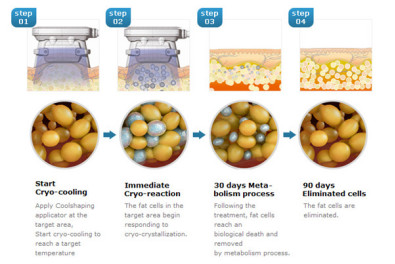 600W Portable 3 IN 1 Fda Cryolipolysis Weight Loss Equipment
