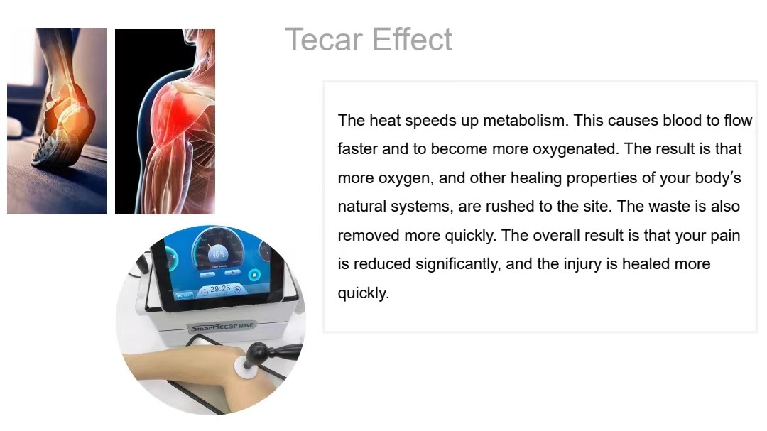Multifunction Smart Tecar Therapy Machine Shockwave ED Treatment