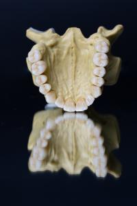 China Dental Lab Porcelain Zirconia Dental Crown 5 Stars Esthetics wholesale