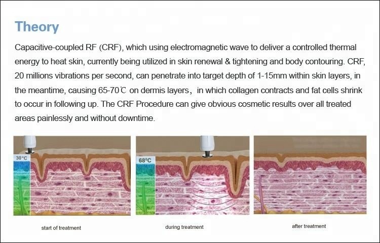 RF Skin Tightening Face Lifting Machine , Fractional RF Beauty Machine