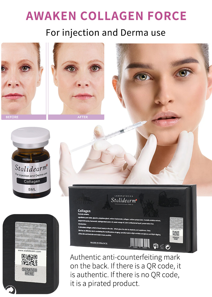 OEM Stalidearm Hair Repair Serum Hair Growth Anti Hair Loss Mesotherapy Serum Injection 5ml