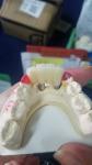 Smooth Surface Biocompatible Zirconia Tooth Crown Easy Maintain