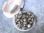 Dental Nickel Base Metal Casting Alloys 220HV10 Hardness Compact Surfaces