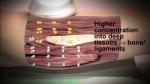 448khz Tecar Therapy Machine Vacuum Cet Ret RF Monopolar Pain Relief Human Pets