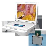 1080P Medical Ultrasound Machine Surgery Laparocsopy Hysteroscopy Camera