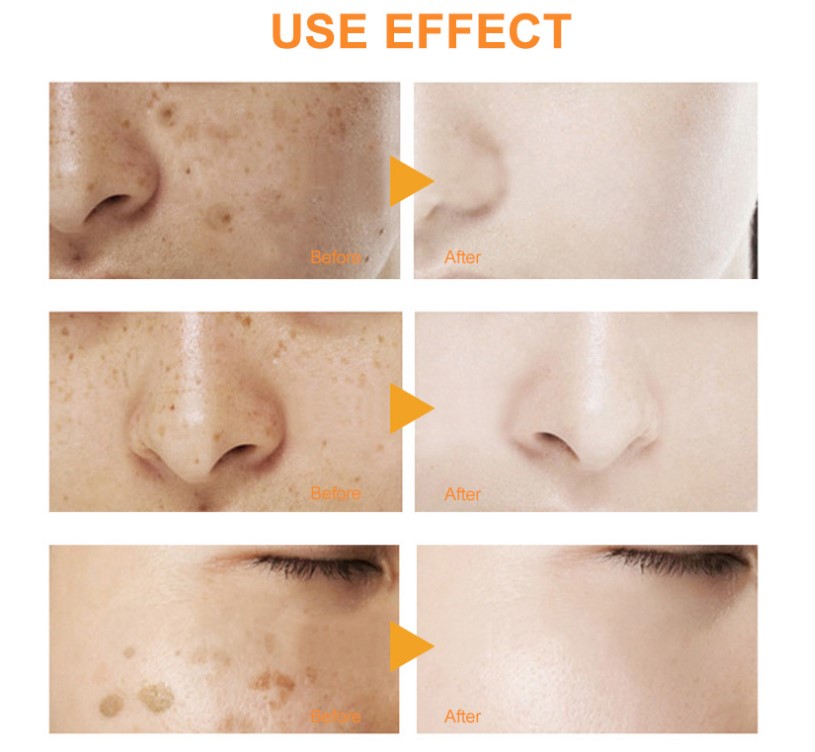 Under Eye Cream for Wrinkles and Bags, 