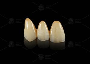 China Durable Hypoallergenic EMAX Bridge Extreme Esthetics Emax Dental Bridge wholesale